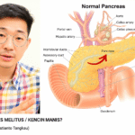 Diabetes dr Cici edit