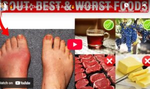 Makanan pantangan dan anjuran asam urat